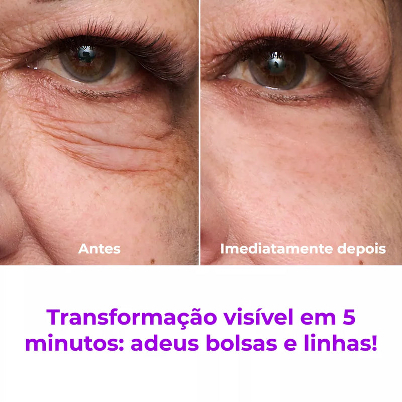 LiftBeauty - Firmador Instantâneo Que Elimina Bolsas, Rugas e Linhas Temporariamente